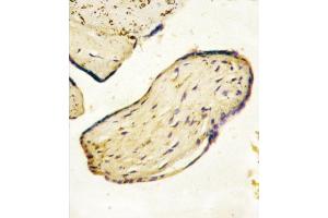 Formalin-fixed and paraffin-embedded human Placenta tissue reacted with CD73 (NT5E) Antibody (C-term) (ABIN388750 and ABIN2839011) , which was peroxidase-conjugated to the secondary antibody, followed by AEC staining. (CD73 抗体  (C-Term))