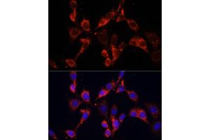 Immunofluorescence analysis of NIH/3T3 cells using DVL2 antibody (ABIN6130335, ABIN6139881, ABIN6139883 and ABIN6223455) at dilution of 1:100. (DVL2 抗体  (AA 1-340))