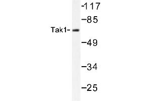 Image no. 1 for anti-Mitogen-Activated Protein Kinase Kinase Kinase 7 (MAP3K7) antibody (ABIN272124) (MAP3K7 抗体)