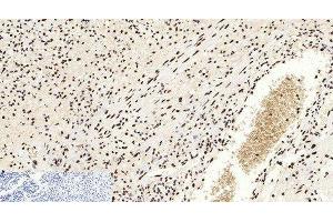 Immunohistochemistry of paraffin-embedded Human appendix tissue using Acetyl-Histone H3 (Lys9) Polyclonal Antibody at dilution of 1:200. (Histone 3 抗体  (acLys9))