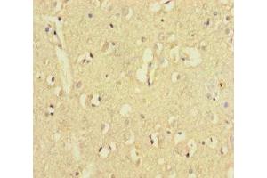 Immunohistochemistry of paraffin-embedded human brain tissue using ABIN7176535 at dilution of 1:100 (ZNF8 抗体  (AA 1-300))