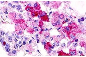 Image no. 1 for anti-G Protein-Coupled Receptor 12 (GPR12) (C-Term) antibody (ABIN1048702) (G Protein-Coupled Receptor 12 抗体  (C-Term))