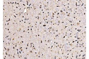 IHC analysis of KLF15 using anti-KLF15 antibody (ABIN7599269).