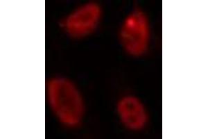 Immunofluorescence (fixed cells) (IF/ICC) image for anti-Inhibitor of DNA Binding 4, Dominant Negative Helix-Loop-Helix Protein (ID4) (N-Term) antibody (ABIN6258853)
