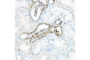 Immunohistochemistry of paraffin-embedded mouse kidney using BC Rabbit pAb (ABIN6131008, ABIN6137483, ABIN6137484 and ABIN6223295) at dilution of 1:100 (40x lens). (BCAT2 抗体  (AA 20-200))