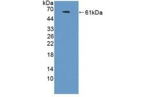 Detection of Recombinant NCAM2, Human using Polyclonal Antibody to Neural Cell Adhesion Molecule 2 (NCAM2) (NCAM2 抗体  (AA 21-297))
