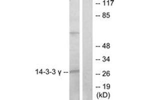 Western blot analysis of extracts from K562 cells, treated with insulin 0. (14-3-3 gamma 抗体  (AA 51-100))