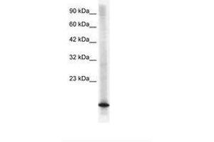 Image no. 1 for anti-Cyclin-Dependent Kinase Inhibitor 2B (p15, Inhibits CDK4) (CDKN2B) (C-Term) antibody (ABIN6735853) (CDKN2B 抗体  (C-Term))