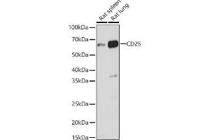 Western blot analysis of extracts of various cell lines, using CD25 antibody (ABIN3017118, ABIN3017119, ABIN3017120 and ABIN6219963) at 1:1000 dilution. (CD25 抗体)
