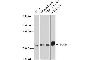 Western blot analysis of extracts of various cell lines using NAA20 Polyclonal Antibody at dilution of 1:1000. (NAT5 抗体)