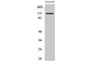 Western Blotting (WB) image for anti-Tripartite Motif Containing 24 (TRIM24) (C-Term) antibody (ABIN3177722) (TRIM24 抗体  (C-Term))