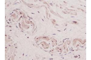 Image no. 1 for anti-Thymic Stromal Lymphopoietin (TSLP) antibody (ABIN465621) (Thymic Stromal Lymphopoietin 抗体)