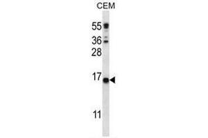 CJ057 Antibody (C-term) western blot analysis in CEM cell line lysates (35µg/lane). (CJ057 抗体  (C-Term))
