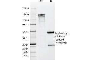 SDS-PAGE Analysis Purified NSE gamma Monoclonal Antibody (SPM347).