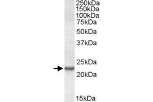 SAR1A polyclonal antibody  (0. (SAR1A 抗体)