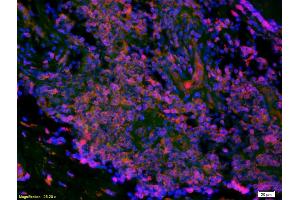 Formalin-fixed and paraffin-embedded human colon labeled with Anti-LI-cadherin Polyclonal Antibody, Unconjugated (ABIN732128) 1:200, overnight at 4°C, The secondary antibody was Goat Anti-Rabbit IgG, Cy3 conjugated used at 1:200 dilution for 40 minutes at 37°C. (LI Cadherin 抗体  (AA 101-200))