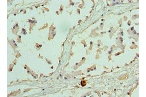 Immunohistochemistry of paraffin-embedded human prostate tissue using ABIN7155474 at dilution of 1:100 (EZH1 抗体  (AA 160-280))
