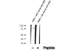 anti-Autophagy Related 13 (ATG13) (pSer355) antibody