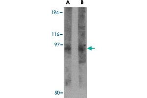 Western blot analysis of TMC8 in rat thymus tissue lysate with TMC8 polyclonal antibody  at (A) 1 and (B) 2 ug/mL . (TMC8 抗体  (N-Term))