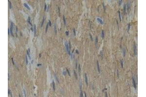 Used in DAB staining on fromalin fixed paraffin- embedded rectum tissue (Plastin 3 抗体  (AA 234-475))