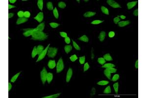 Immunofluorescence of purified MaxPab antibody to PSMD10 on HeLa cell. (PSMD10 抗体  (AA 1-226))