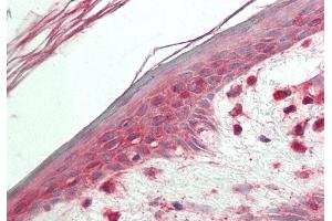 Rabbit Anti-VPS52 antibody Catalog Number: ARP57644 Formalin Fixed Paraffin Embedded Tissue: Human Skin Primary antibody Concentration: 1:100 Secondary Antibody: Donkey anti-Rabbit-Cy3 Secondary Antibody Concentration: 1:200 Magnification: 20x Exposure Time: 0. (VPS52 抗体  (Middle Region))