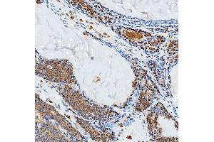 IHC analysis of SFXN3 using anti-SFXN3 antibody (ABIN7601302).
