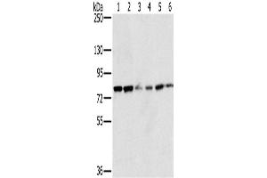 Western Blotting (WB) image for anti-NADPH Oxidase 5 (NOX5) antibody (ABIN2430559)