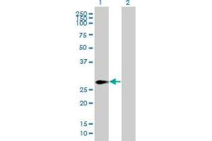 Western Blot analysis of SPANXN2 expression in transfected 293T cell line by SPANXN2 MaxPab polyclonal antibody. (SPANXN2 抗体  (AA 1-180))