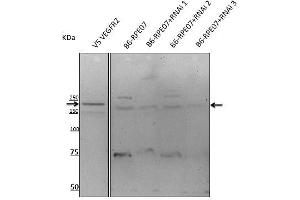 Anti-VEGFR2 antibody at 1/500 dlution, rabbit palyclonal to goat lgG (HRP), at 1/10,000 dilution, (VEGFR2/CD309 抗体  (AA 20-125))