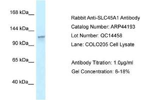 WB Suggested Anti-SLC45A1 Antibody   Titration: 1. (SLC45A1 抗体  (N-Term))