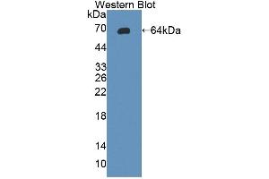 Detection of Recombinant gp130, Rat using Polyclonal Antibody to Glycoprotein 130 (gp130) (CD130/gp130 抗体  (AA 26-323))