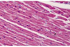 Human Heart: Formalin-Fixed, Paraffin-Embedded (FFPE) (BID 抗体  (C-Term))