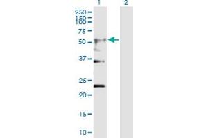 Western Blot analysis of CHRNA4 expression in transfected 293T cell line by CHRNA4 MaxPab polyclonal antibody. (CHRNA4 抗体  (AA 1-451))