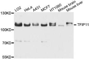 Western blot analysis of extracts of various cell lines, using TFIP11 antibody (ABIN5996279) at 1/1000 dilution. (TFIP11 抗体)