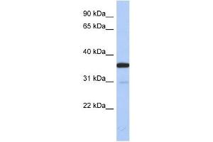 ESD antibody used at 1 ug/ml to detect target protein. (Esterase D 抗体  (N-Term))