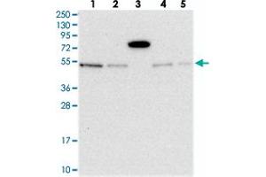 Western blot analysis of Lane 1: RT-4, Lane 2: U-251 MG, Lane 3: Human Plasma, Lane 4: Liver, Lane 5: Tonsil with MSANTD2 polyclonal antibody  at 1:250-1:500 dilution. (MSANTD2 抗体)