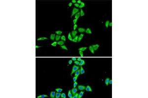 Immunofluorescence analysis of HeLa cells using CES2 Polyclonal Antibody (CES2 抗体)
