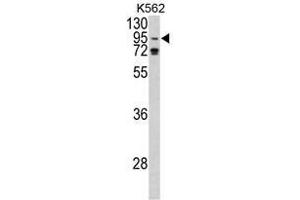 Image no. 1 for anti-Eukaryotic Translation Initiation Factor 2C, 1 (EIF2C1) (N-Term) antibody (ABIN452723) (AGO1 抗体  (N-Term))