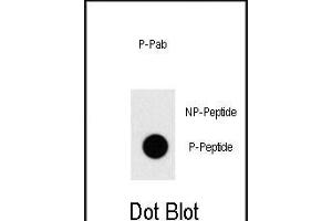 Dot blot analysis of anti-Phospho-TAL1-pT90 Pab (ABIN650830 and ABIN2839799) on nitrocellulose membrane.