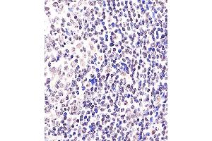 (ABIN6243067 and ABIN6578362) staining BCL6 in Human tonsil tissue sections by Immunohistochemistry (IHC-P - paraformaldehyde-fixed, paraffin-embedded sections). (BCL6 抗体  (AA 364-395))