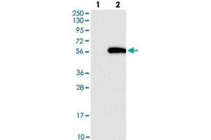 Western blot analysis of Lane 1: Negative control (vector only transfected HEK293T lysate), Lane 2: Over-expression Lysate (Co-expressed with a C-terminal myc-DDK tag (~3. (GALNTL5 抗体)