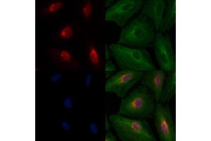 ABIN6260520 and ABIN6276510 staining  cells by IF/ICC.