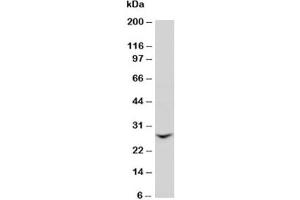 Western blot testing of GJB2 antibody and rat liver tissue lysate (GJB2 抗体  (N-Term))