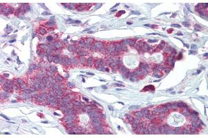 Immunohistochemistry (IHC) image for anti-Homeobox A5 (HOXA5) (C-Term) antibody (ABIN2781081)