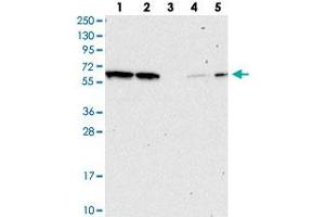 Western blot analysis of Lane 1: RT-4, Lane 2: U-251 MG, Lane 3: Human Plasma, Lane 4: Liver, Lane 5: Tonsil with NAE1 polyclonal antibody . (NAE1 抗体)