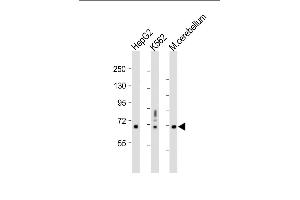 All lanes : Anti-TCF4 Antibody (N-term) at 1:1000 dilution Lane 1: HepG2 whole cell lysate Lane 2: K562 whole cell lysate Lane 3: Mouse cerebellum whole tissue lysate Lysates/proteins at 20 μg per lane. (TCF4 抗体  (N-Term))