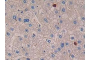 Immunohistochemistry (IHC) image for anti-Interleukin 16 (IL16) (AA 1203-1332) antibody (ABIN7430693)