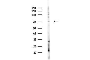 anti-MYST Histone Acetyltransferase 2 (MYST2) (Internal Region) antibody