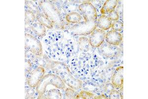 Immunohistochemistry of paraffin-embedded rat kidney using RLN2 antibody at dilution of 1:200 (40x lens). (Relaxin 2 抗体)